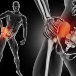 syndrome du piriforme nice-sciatique alpes maritimes-osteopathe nice-osteopathie saint laurent du var-osteopathe pour sportifs alpes maritimes-cabinet d osteopathie nice